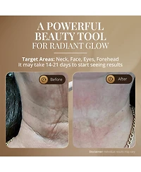 GLO24K Neck & Face Led Beauty Massager + 24k Night Cream
