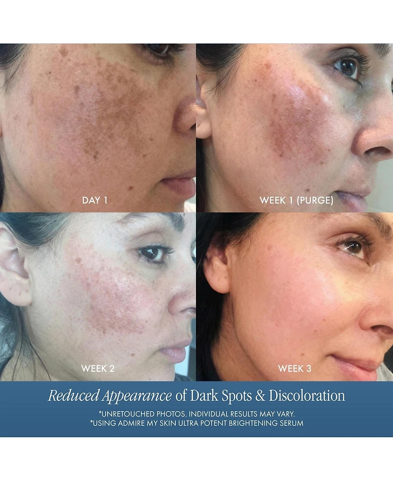 Ultra Potent Brightening Serum Dark Spot Corrector