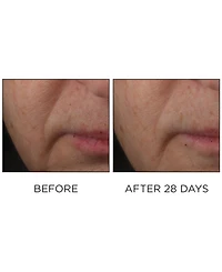 Perricone Md Cold Plasma Plus+ Advanced Serum Concentrate, 1 oz.