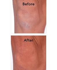 Lavido Thera Intensive Body Cream, 8.45-oz.