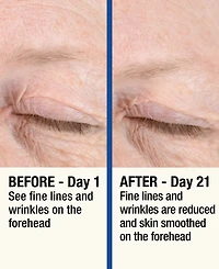 7LS by HoMedics ReMOVE Micro Dermabrasion Device with Cooling Surface