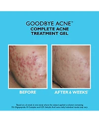Peter Thomas Roth Goodbye Acne Complete Acne Treatment Gel