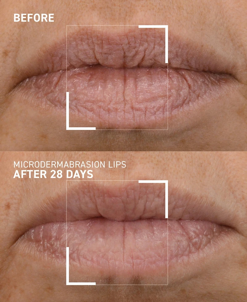 Dr. Brandt Smoothing Lip Exfoliator, 10 g