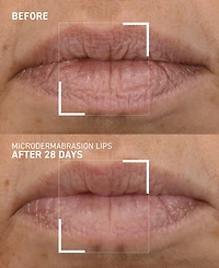 Dr. Brandt Smoothing Lip Exfoliator, 10 g