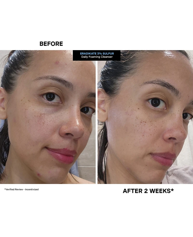 Kate Somerville EradiKate Daily Foaming Cleanser Mini