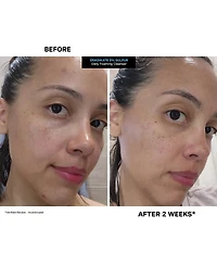 Kate Somerville EradiKate Daily Foaming Cleanser Mini
