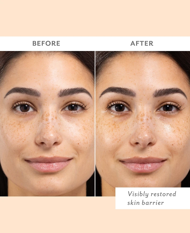 Patchology Skin Remedy Barrier-Boosting Sheet Mask, 4-Pk.