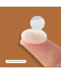 Night Silk + Salicylic Acid Microdart Pimple Patches 48-Pack