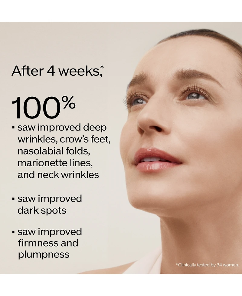 Shiseido Vital Perfection Intensive WrinkleSpot Treatment A+, 1 oz.