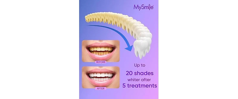 MySmile 4Pcs 35% Non-Sensitive Teeth Whitening Gel Refill Pack Kit for Whitening Teeth, Mint Flavor Teeth Whitener (Not Include Led Mouth Tray)