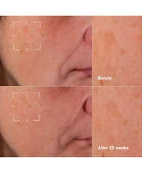 Clinique 3-Pc. Even Better Mini Skincare Kit