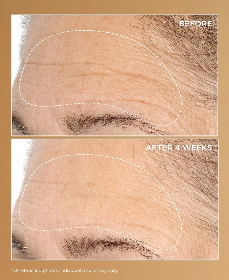 Perricone Md Neuropeptide Deep Crease Serum, 1 oz.