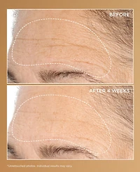 Perricone Md Neuropeptide Deep Crease Serum, 1 oz.