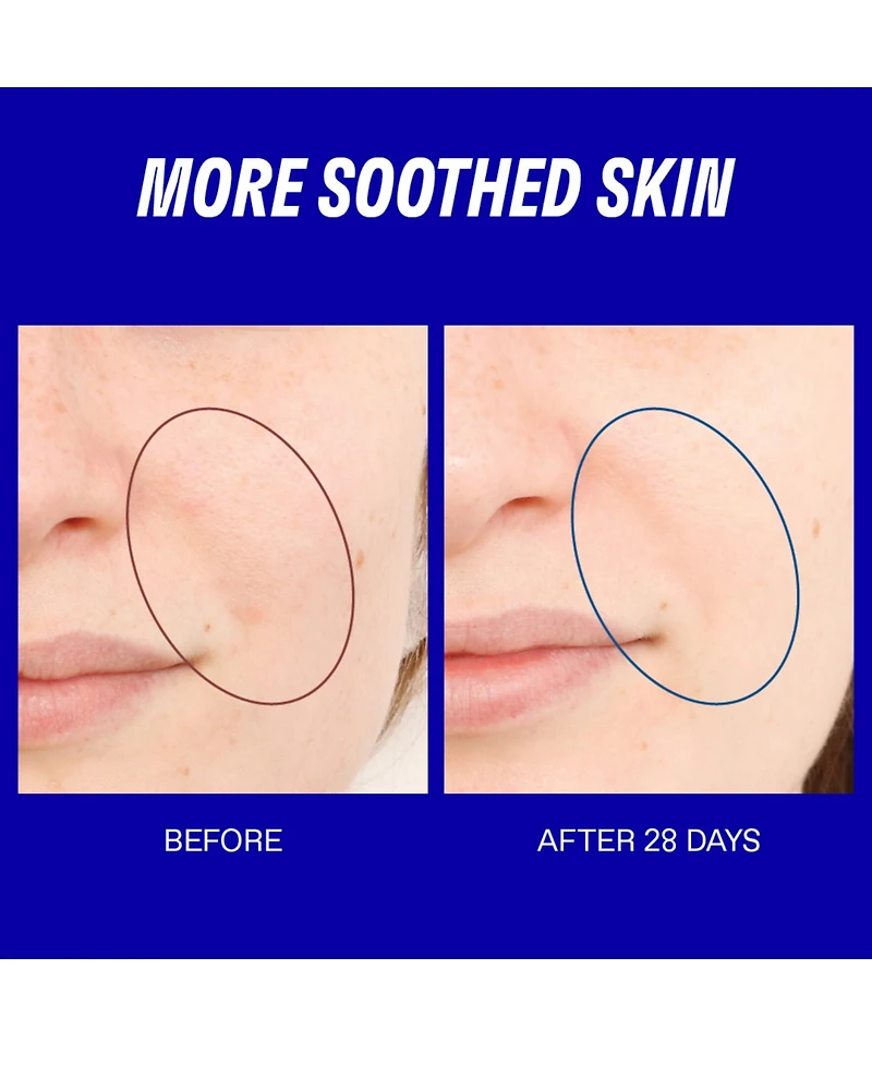 Korres Greek Yoghurt Skin-Supplement Serum, 30 ml