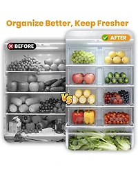Xdovet Stackable Plastic Organizers with Handles Movable Dividers