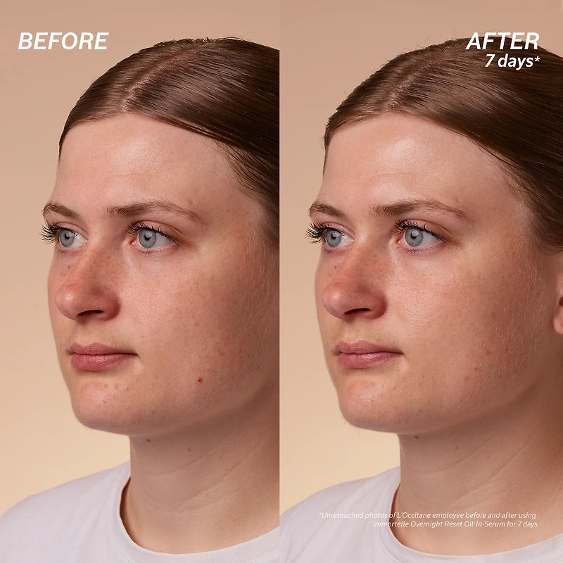 Immortelle Overnight Reset Oil-in-Serum