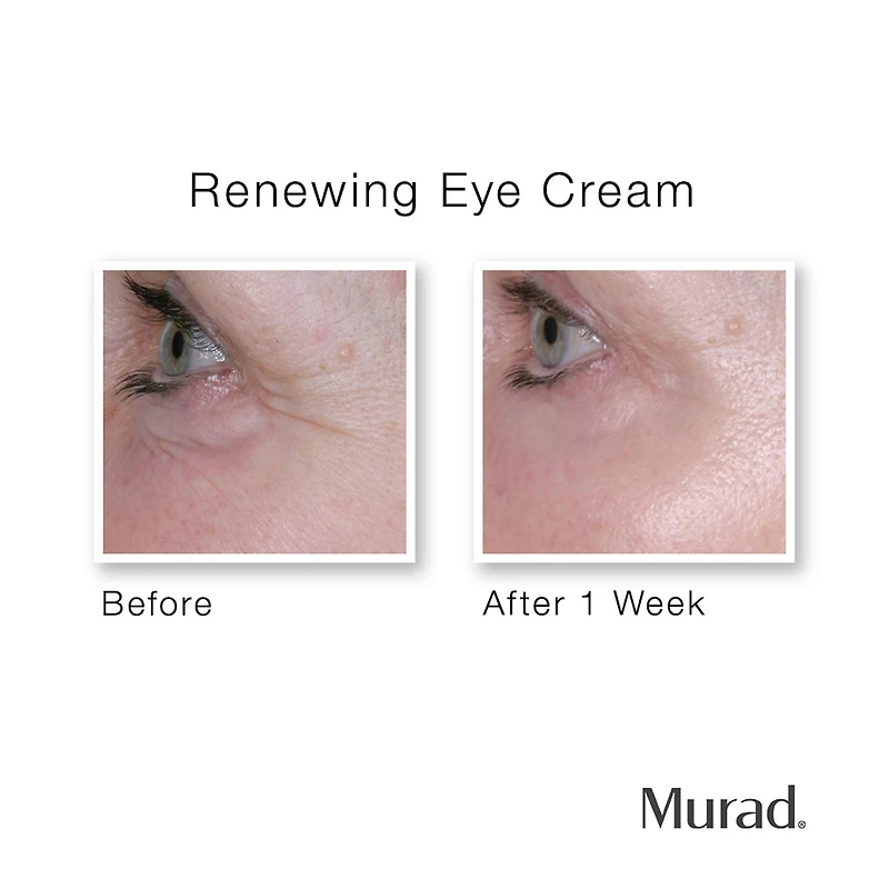 Crème contour des yeux régénérante