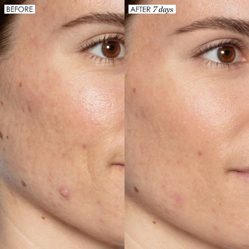Good Genes All-In-One Lactic Acid Serum For Dark Spots And Uneven Texture