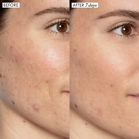 Good Genes All-In-One Lactic Acid Serum For Dark Spots And Uneven Texture