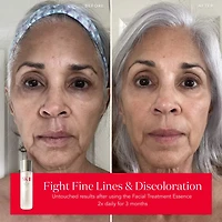 Soin antiâge du visage Essence avec antioxydants
