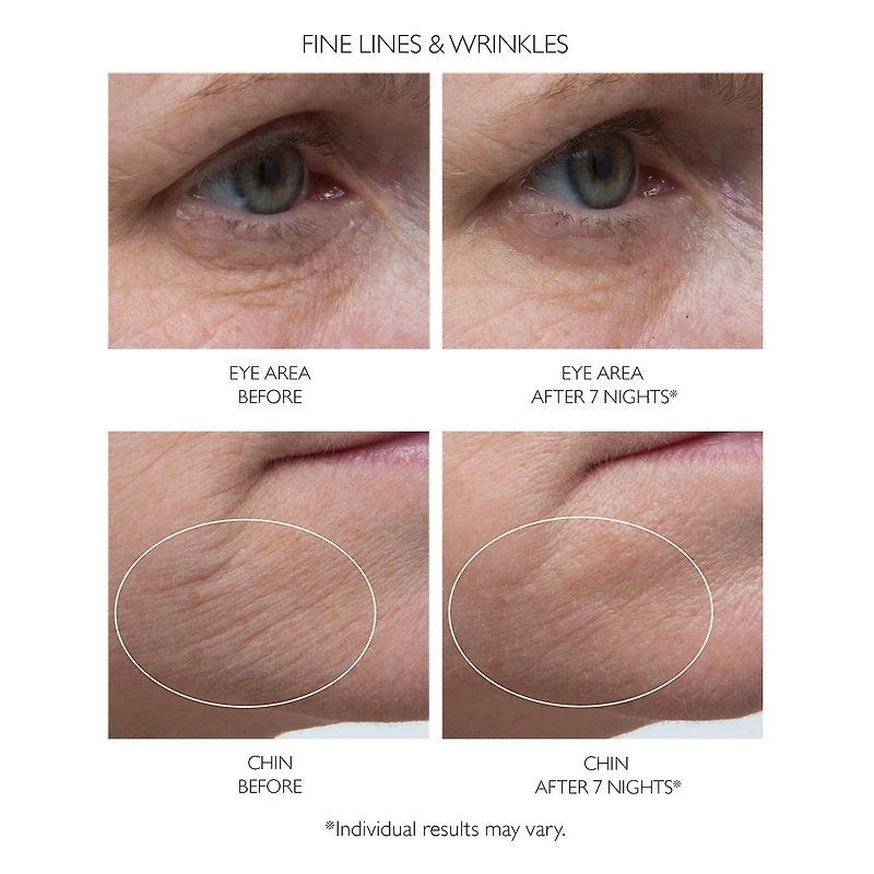 Sérum de nuit Retinol Fusion PM