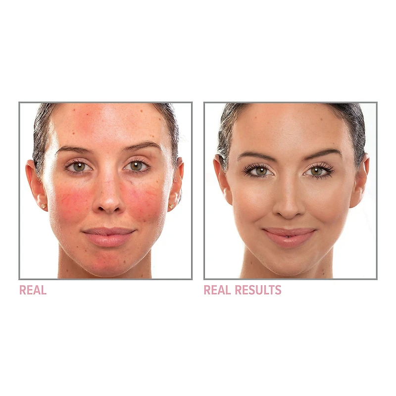 Crème correctrice neutralisante Bye Redness™