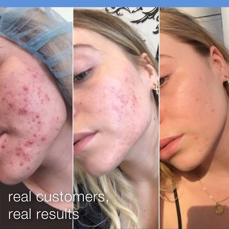 Exfoliant rechargeable Daily Microfoliant