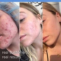 Exfoliant rechargeable Daily Microfoliant