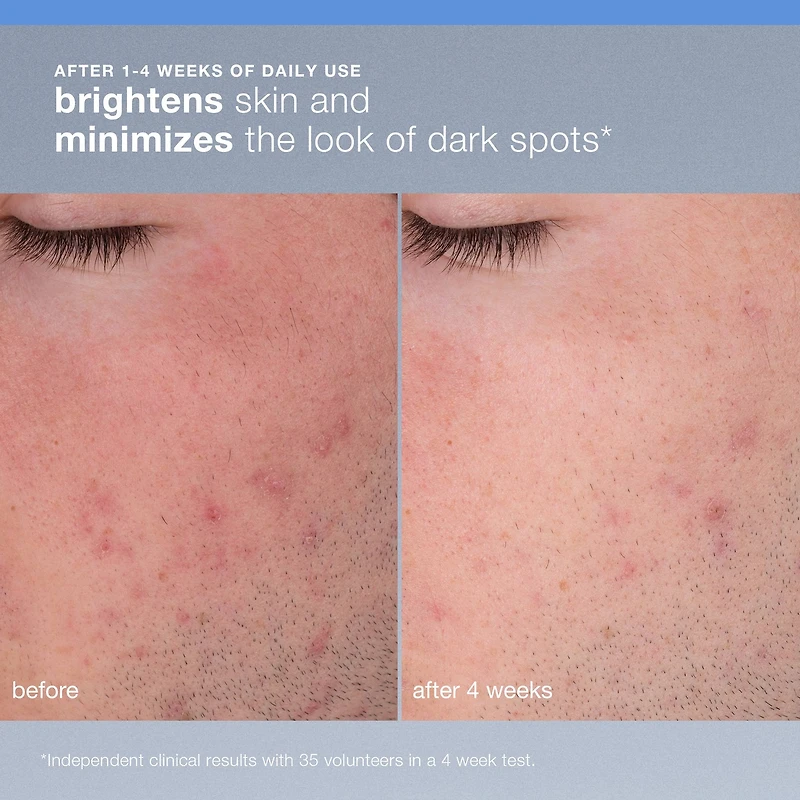 Exfoliant rechargeable Daily Microfoliant