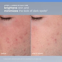Exfoliant rechargeable Daily Microfoliant