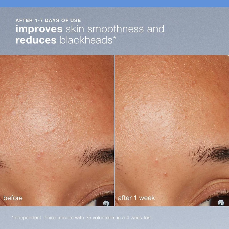 Exfoliant rechargeable Daily Microfoliant