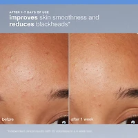 Exfoliant rechargeable Daily Microfoliant