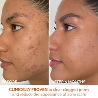 Mini Alpha Beta® Extra Strength Daily Peel Pads