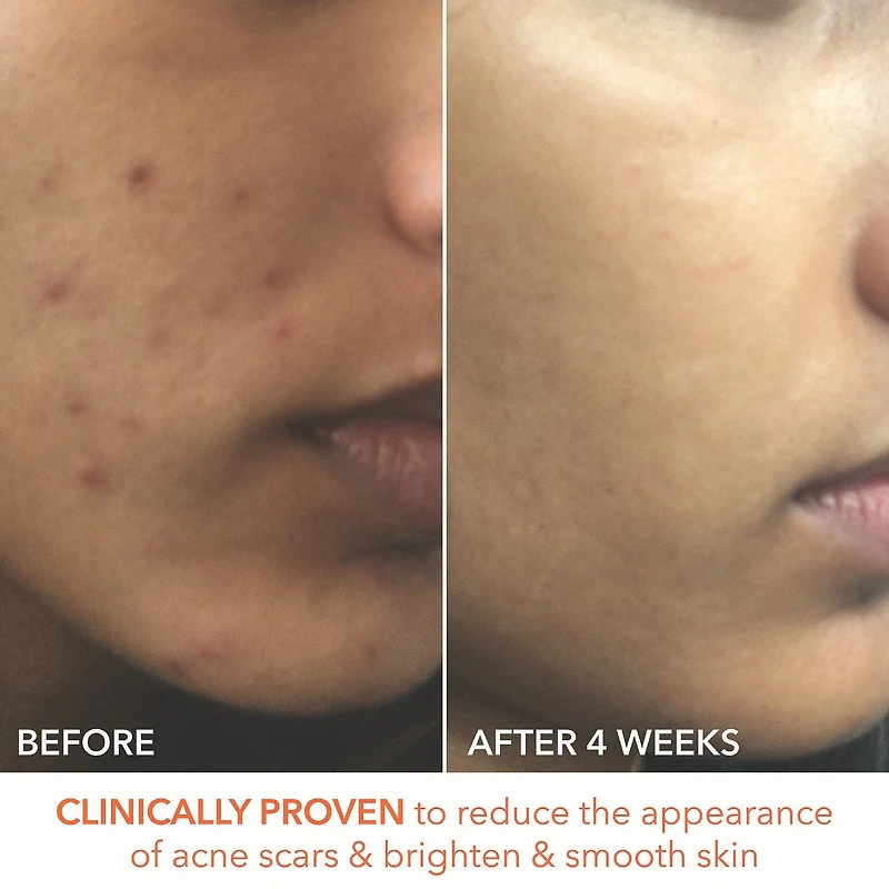 Mini Alpha Beta® Extra Strength Daily Peel Pads