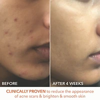 Mini Alpha Beta® Extra Strength Daily Peel Pads