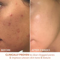 Mini Alpha Beta® Extra Strength Daily Peel Pads