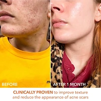 Mini Alpha Beta® Universal Daily Peel Pads