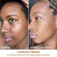 Mini Alpha Beta® Universal Daily Peel Pads