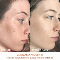 Mini Alpha Beta® Universal Daily Peel Pads