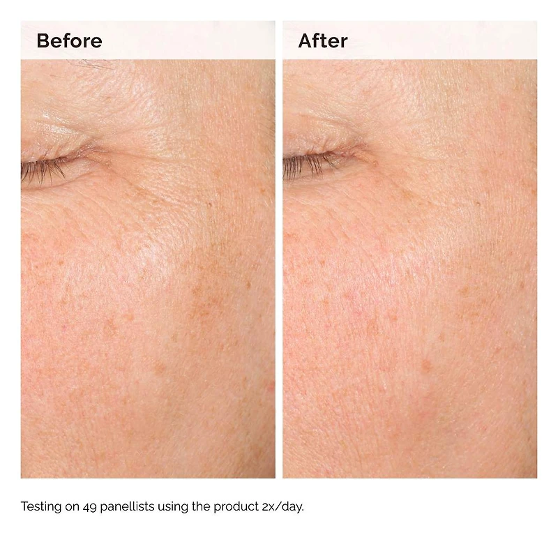 Sérum d’hyperpigmentation Alpha Arbutin 2 % + HA