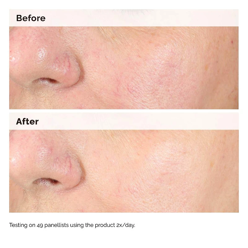 Sérum d’hyperpigmentation Alpha Arbutin 2 % + HA