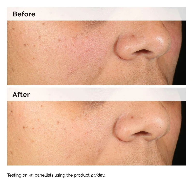 Sérum d’hyperpigmentation Alpha Arbutin 2 % + HA