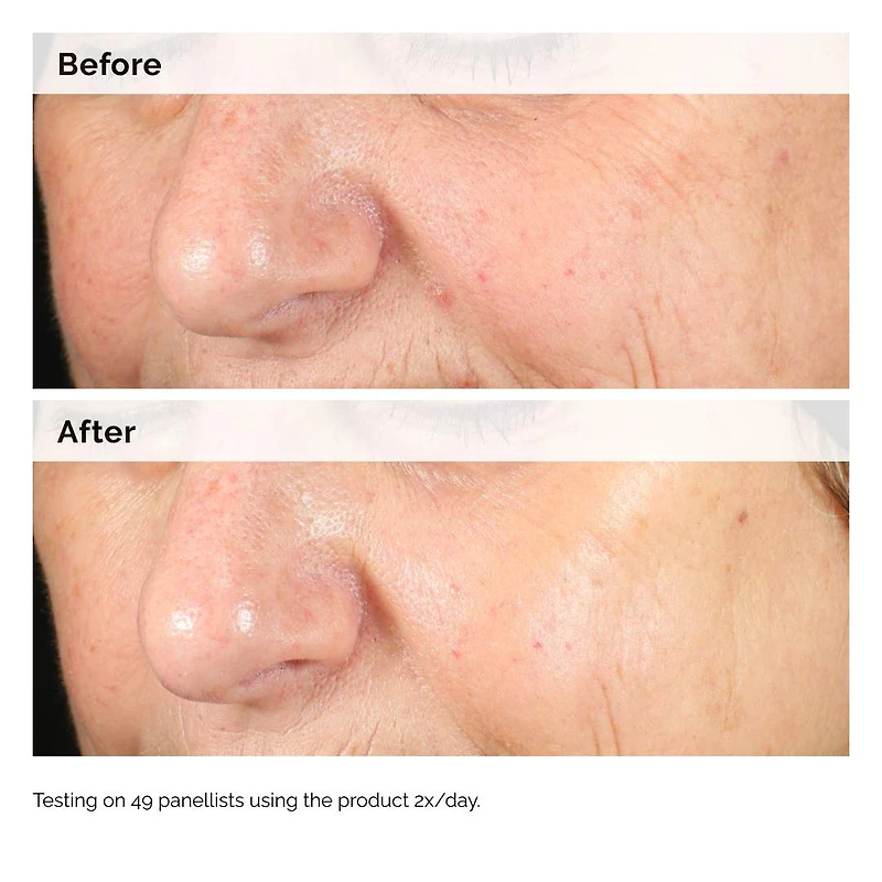 Sérum d’hyperpigmentation Alpha Arbutin 2 % + HA