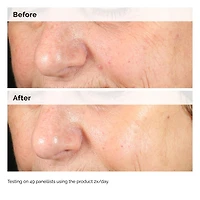 Sérum d’hyperpigmentation Alpha Arbutin 2 % + HA