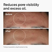 Sérum régulateur de sébum avec niacinamide à 10 % et zinc 1 %