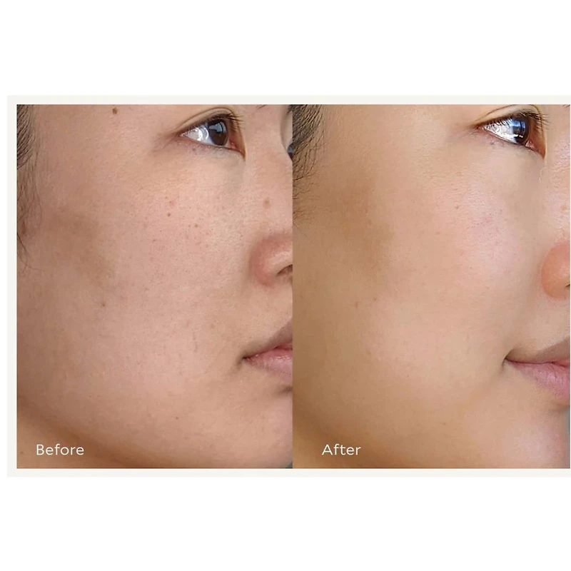 Sérum resurfaçant et illuminateur avec AHA + BHA et vitamine C