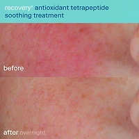 Redness Recovery + Antioxidant Peptide Treatment Mask