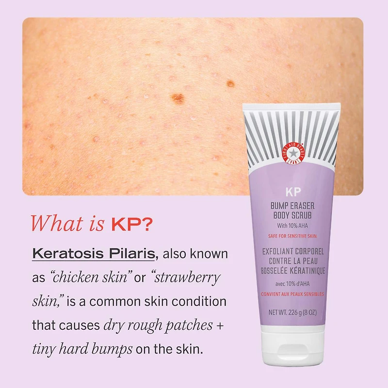 Exfoliant pour le corps KP Bump Eraser avec 10 % d’AHA cibler la kératose pilaire