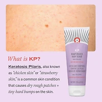 Exfoliant pour le corps KP Bump Eraser avec 10 % d’AHA cibler la kératose pilaire
