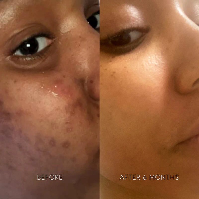 Masque purifiant